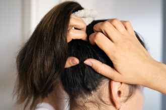 Itchy Scalp remedies