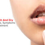 dry mouth causes