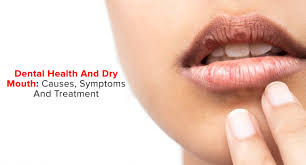 dry mouth causes