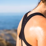 excessive sweating fix
