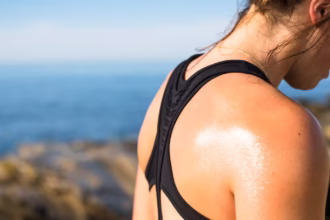 excessive sweating fix